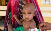 Halimo Hassan (1 year and 2 months) and mother Khayro Ali Hassan in a remote health centre in Filtu, Somali Region. Halimo is being treated for severe acute malnutrition with the support of International NGO Concern Worldwide. Ethiopia. Photo: Jennifer Nolan/ Concern Worldwide
