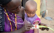 Lokaale uses a MUAC band to check if Loonkwo is malnourished.