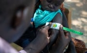 A child has his arm circumference measured for malnutrition