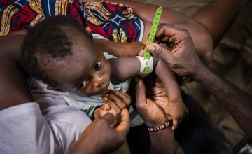 One-year-old Cecelia being tested for malnutrition.