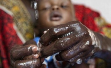 A mother in Ethiopia washes her child’s hands with soap and water at a Concern nutrition clinic. Photo: Kieran McConville