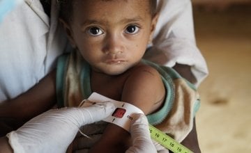 After having his upper arm circumference measured by Concern staff at a nutrition centre in Cox’s Bazar, Bangladesh, little Rama is diagnosed as being severely malnourished. Photo: Abir Abdullah