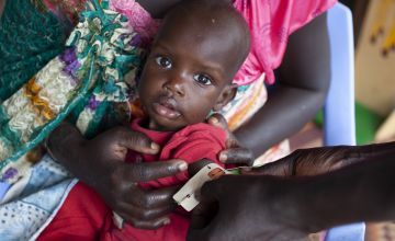 Concern staff treat a child for malnutrition at one of Concern's nutrition centres inside a camp for displaced people in Juba, South Sudan.