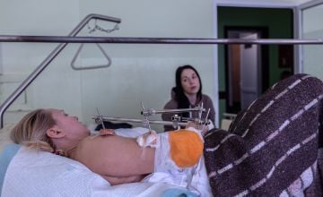 Ana, 39, was injured by shrapnel and is recovering in hopsital in Mykolaiv. Photo: Stefanie Glinski/Concern Worldwide