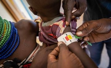 A child’s arm is measured at a malnutrition clinic in Lekwasimyen in Northern Kenya's Turkana province. Photo: Lisa Murray / Concern Worldwide.