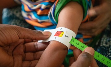 A close up of a child's arm being measured with a tape that screens for malnutrition.
