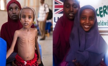 Yasmiin before treatment and after The best kind of “before and after.” When Yasmiin arrived at our clinic, she was severely malnourished. After nine weeks of treatment, she was a happy, smiley kid again.