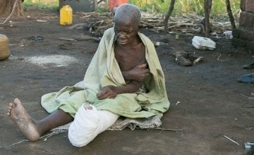 Dominga Gambulene was injured when the family home in Chicuacha village, Lamego collapsed during Cyclone Idai. Photo: Kieran McConville/Concern Worldwide.