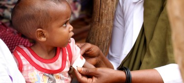 Sabrir, 10 months old, has her upper arm measured in Suftu, Ethiopia. Photo: Adan Mohamed Afar/Concern Worldwide.