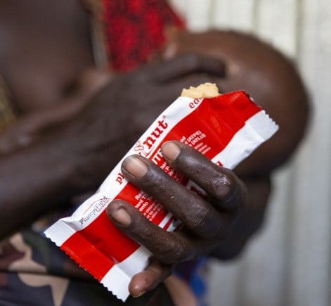 Close-up of a child's hand holding an opened sachet of ready-to-use therapeutic food (RUTF), with the nutrient-rich paste visible at the top. The child is held in an adult's arms in the background.