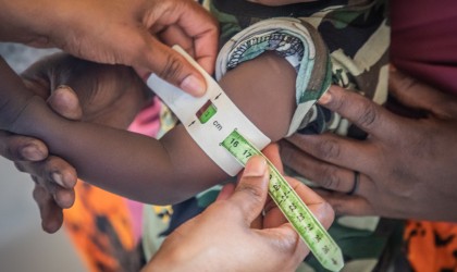 Awaale is 1 1/2 years old. He's one of the lucky children who has access to this local medical centre.  Photo: Gavin Douglas/Concern Worldwide