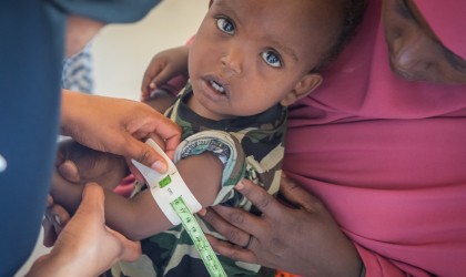 18-month old Awaale has his health monitored at a local clinic. Photo: Gavin Douglas / Concern Worldwide / Somalia