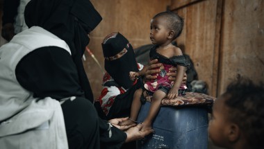  healthcare worker dressed in black clothing with a white vest is examining a small child seated on a blue plastic container. Another person wearing patterned clothing and a black face covering supports the child. The child is wearing a red and black outfit and appears thin, with visible ribs and limbs. The setting looks modest, with a brown wall in the background and another child partially visible in the foreground.