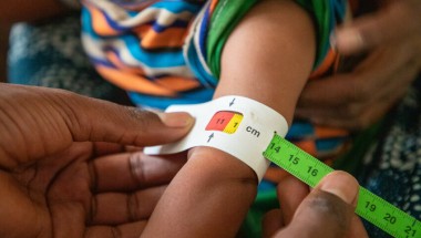 9-month-old Tenay has her MUAC taken. Photo: Eugene Ikua/Concern Worldwide.