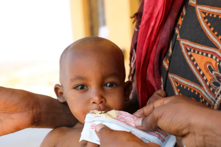 Halimo Hassan (1 year and 2 months) and mother Khayro Ali Hassan (30) in a remote health centre in Filtu, Somali Region. Halimo is being treated for severe acute malnutrition with the support of International NGO Concern Worldwide. Photo: Jennifer Nolan/ Concern Worldwide Halimo Hassan (1 year and 2 months) and mother Khayro Ali Hassan (30) in a remote health centre in Filtu, Somali Region. Halimo is being treated for severe acute malnutrition with the support of International NGO Concern Worldwide. Photo: Jennifer Nolan/ Concern Worldwide