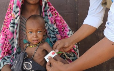 Mother and child in a health centre in Somali Region. Photo: Jennifer Nolan/ Concern Worldwide.
