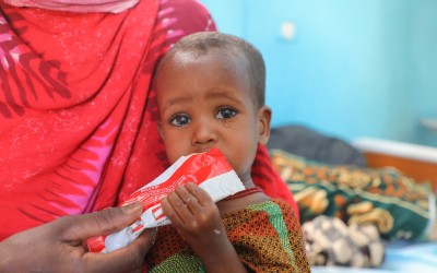 Baby Kali (18 months old) in Filtu Regional Hospital, Somali Region, Ethiopia. Kali is being treated for severe acute malnutrition with the support of International NGO Concern Worldwide. Photo: Jennifer Nolan/ Concern Worldwide