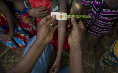 Concern's Nutrition Manager Justin M'pia carries out an impromptu health screening of babies and young children who have gathered with their mums outside Pama Health Facility. Photo: Chris de Bode / CAR