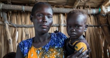 Angelina with her daughter Nyachar (3) at Chotyiel Primary Health Care Centre, Guit County, Unity State, South Sudan. Photo: Eugene Ikua/Concern Worldwide 