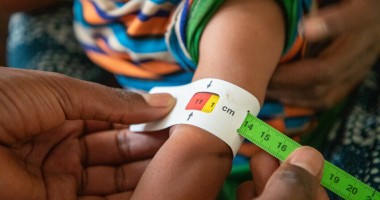 9-month-old Tenay has her MUAC taken. Photo: Eugene Ikua/Concern Worldwide.