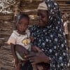 Rouaya Zahirou with her son Salouhou (1) at their home in Zardana Satourou village. Salouhou has just been admitted into Concern’s nutrition programme and has started treatment for Severe Acute Malnutrition. Photo: Apsatou Bagaya / Concern Worldwide. Rouaya Zahirou with her son Salouhou (1) at their home in Zardana Satourou village. Salouhou has just been admitted into Concern’s nutrition programme and has started treatment for Severe Acute Malnutrition. Photo: Apsatou Bagaya / Concern Worldwide.