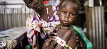Two-year-old Gatkuoth gets his arm measured, which is in the red scale, meaning he is malnourished.