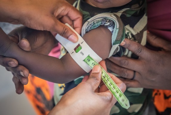 Awaale is 1 1/2 years old. He's one of the lucky children who has access to this local medical centre.  Photo: Gavin Douglas/Concern Worldwide