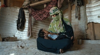 A mother cradles her young son in a displacement camp in Yemen