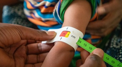 9-month-old Tenay has her MUAC taken. Photo: Eugene Ikua/Concern Worldwide.