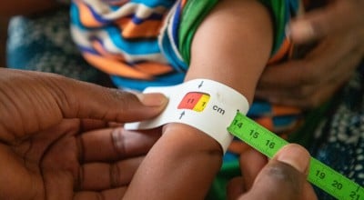 9-month-old Tenay has her MUAC taken. Photo: Eugene Ikua/Concern Worldwide.