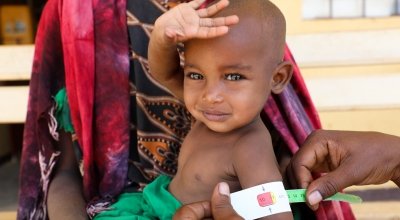 Halimo Hassan (1 year and 2 months) and mother Khayro Ali Hassan (30) in a remote health centre in Filtu, Somali Region. Halimo is being treated for severe acute malnutrition with the support of International NGO Concern Worldwide. Photo: Jennifer Nolan/ 
