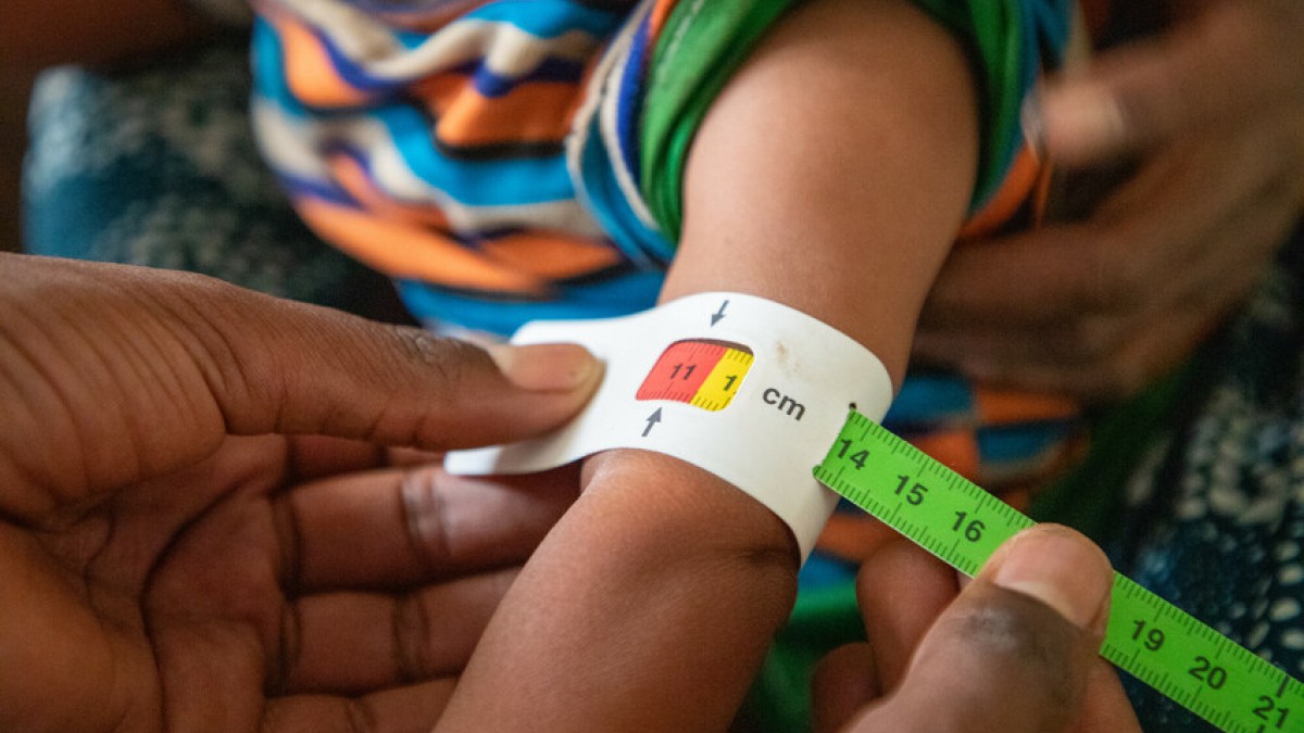 The Family MUAC Approach in Ethiopia | Concern Worldwide